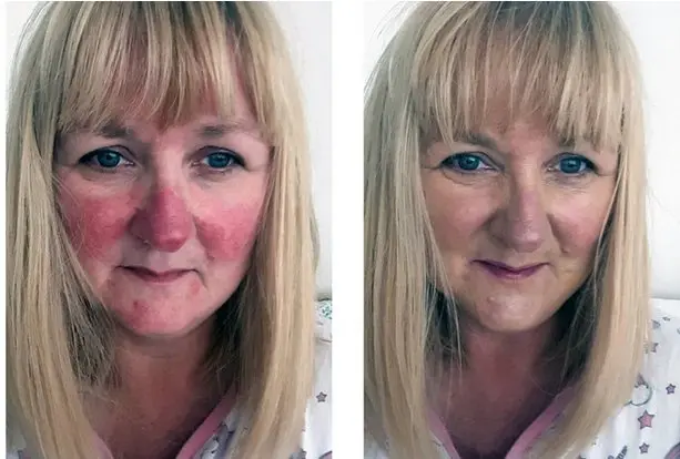 schoonheidssalon zwolle Screenshot 1453